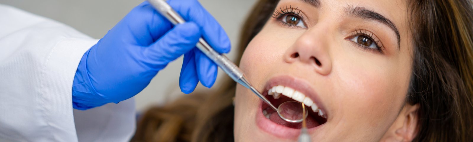 ¿Cada cuánto debo hacerme una limpieza dental?