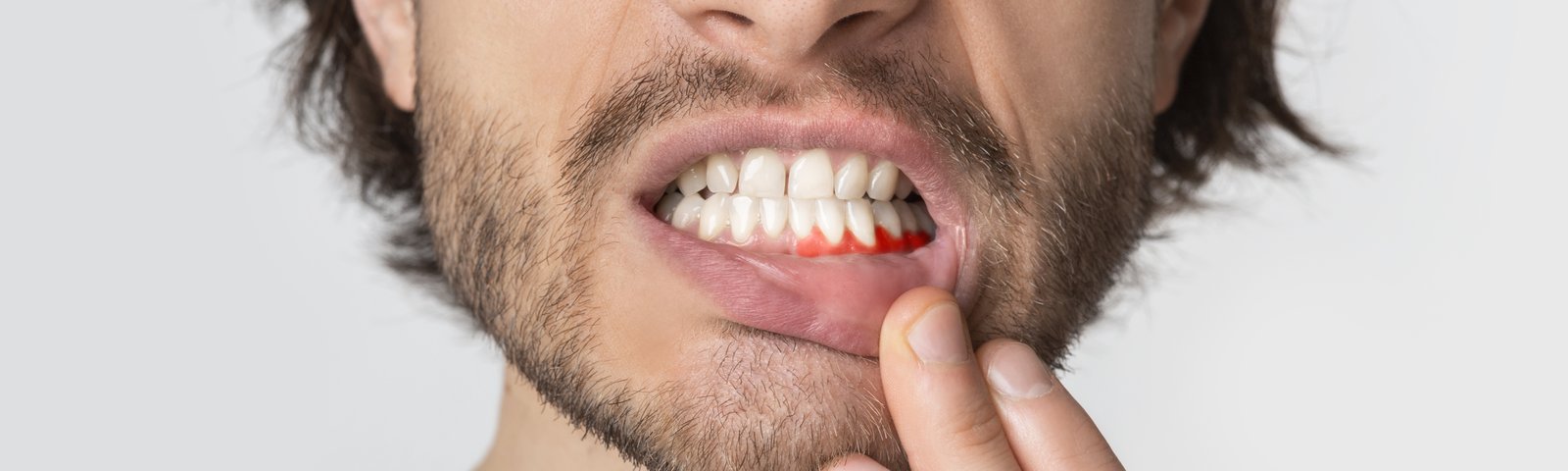 Las enfermedades dentales más frecuentes